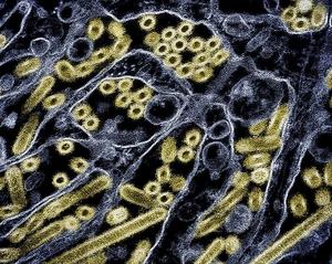 Micrographie électronique à transmission colorisée des particules du virus H5N1 de la grippe aviaire A (illustration)