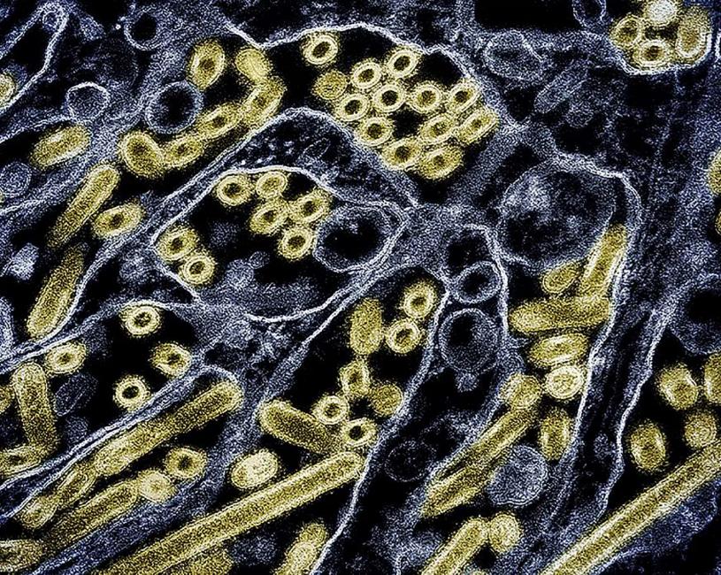 Micrographie électronique à transmission colorisée des particules du virus H5N1 de la grippe aviaire A (illustration)