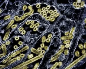 Micrographie électronique à transmission colorisée des particules du virus H5N1 de la grippe aviaire A (illustration)