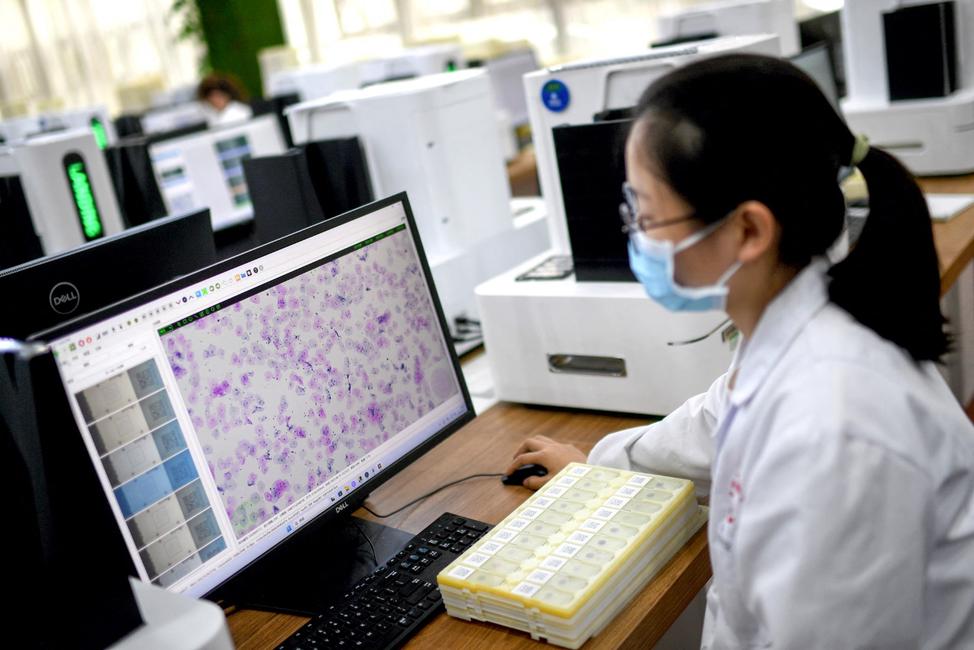 Un technicien de laboratoire effectuant un dépistage du cancer du col de l'utérus par intelligence artificielle dans un centre d'essais à Wuhan.
