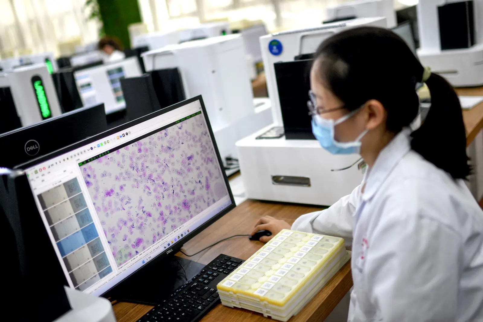 Un technicien de laboratoire effectuant un dépistage du cancer du col de l'utérus par intelligence artificielle dans un centre d'essais à Wuhan.