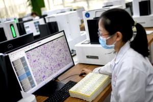 Un technicien de laboratoire effectuant un dépistage du cancer du col de l'utérus par intelligence artificielle dans un centre d'essais à Wuhan.