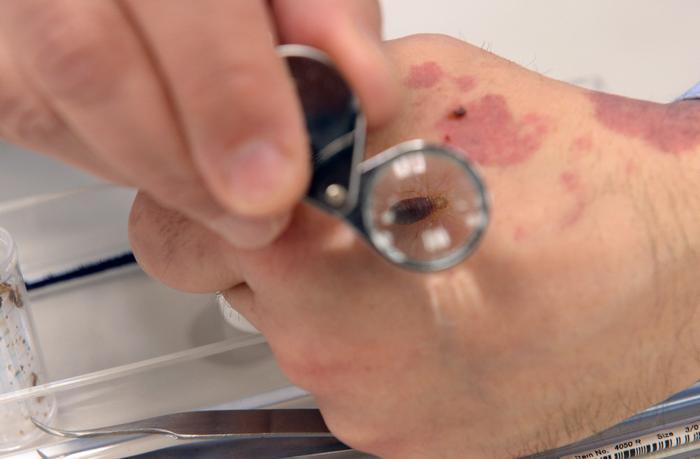 punaises de lit - AFP