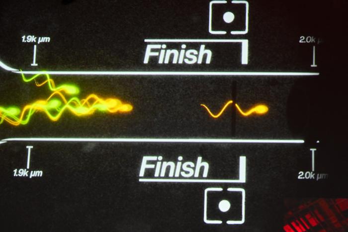 Une image d'illustration du championnat de course de sperme à Los Angeles, en Californie, le 25 avril 2025.