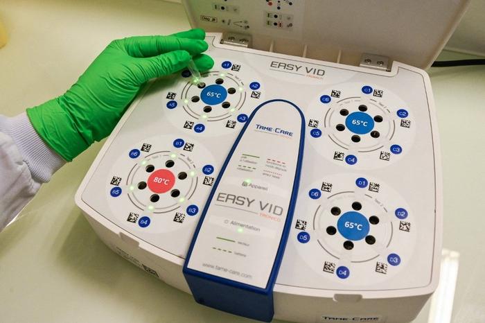 test salivaire covid-19 AFP