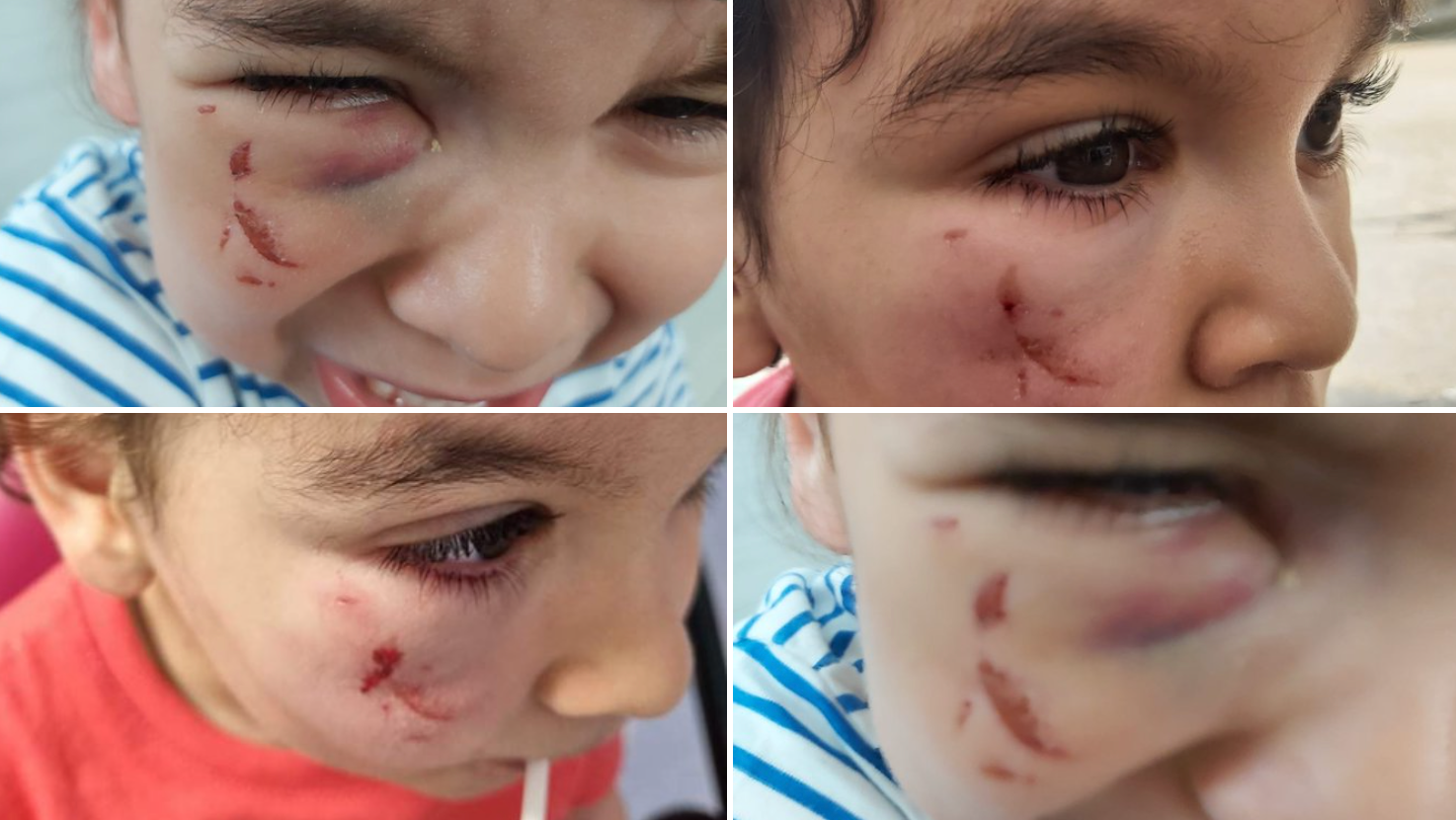 Fillette agressée par une toxicomane