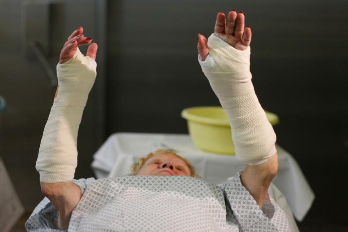 Plâtres. (Image d'illustration)