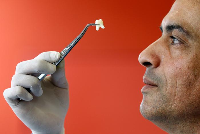 Dent. (Image d'illustration)