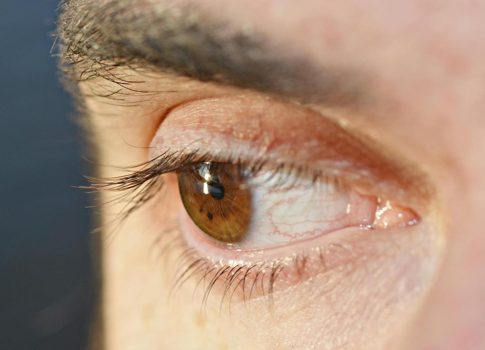 Nos cils ne sont pas seulement esthétiques. Ils jouent un rôle important dans la protection de nos yeux.
