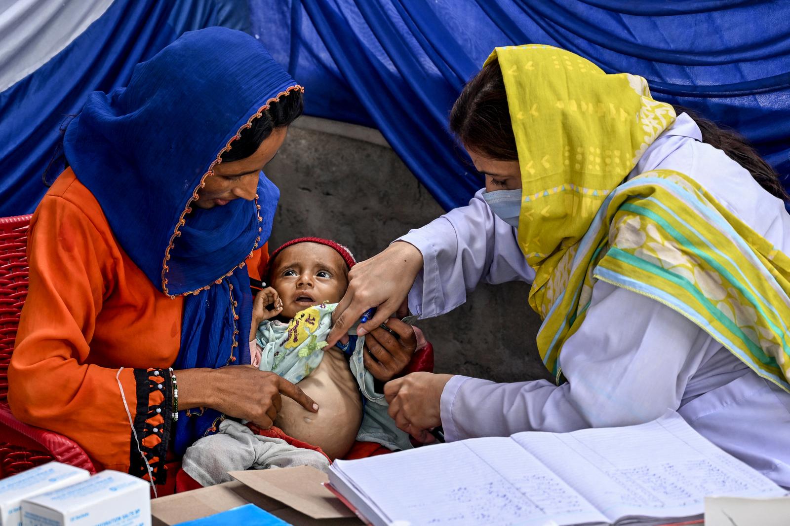 Cette photographie prise le 29 juillet 2025 montre une femme médecin (à droite) examinant un enfant lors d'un programme de nutrition de l'UNICEF dans la province du Sindh, au Pakistan.