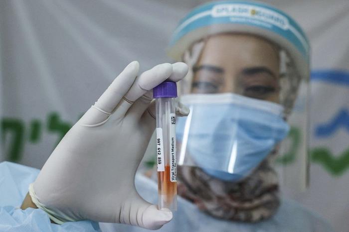 Covid-19 test analyse AFP