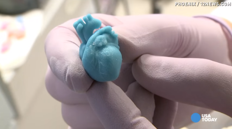 Coeur imprimé en 3D