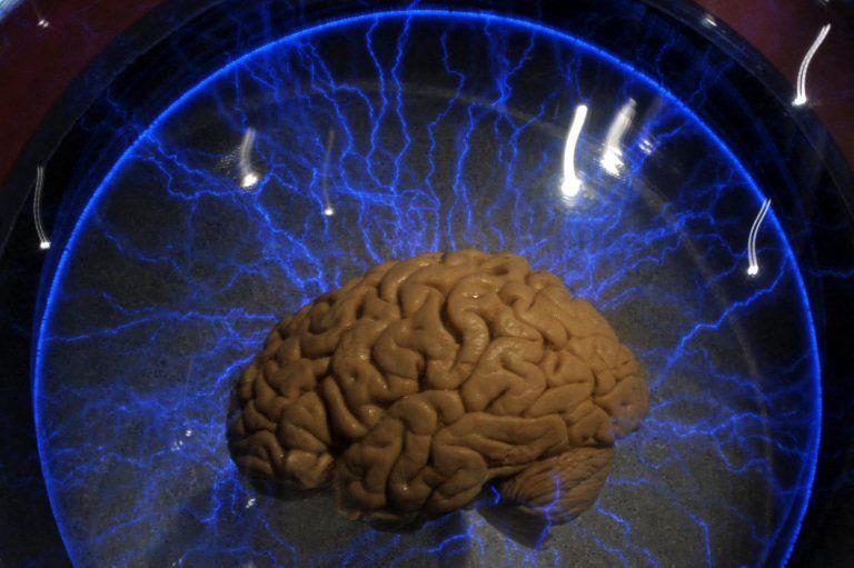 cerveau humain