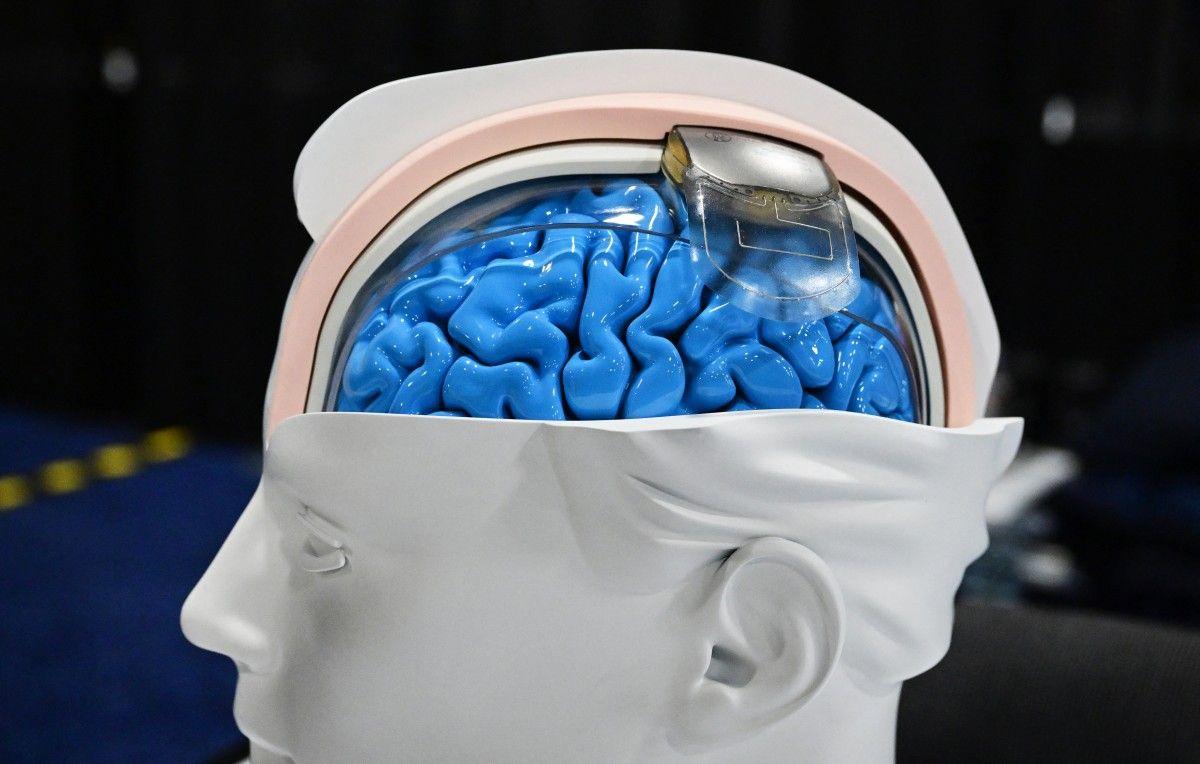 cerveau 2024