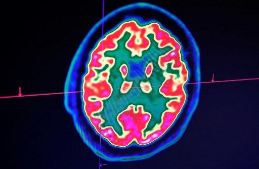 Cerveau - AFP