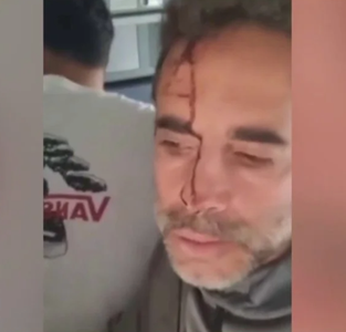 Un vol reliant Dubaï à Tel-Aviv a été dérouté vers l'Arabie saoudite mercredi 30 septembre après une violente altercation entre les deux pilotes