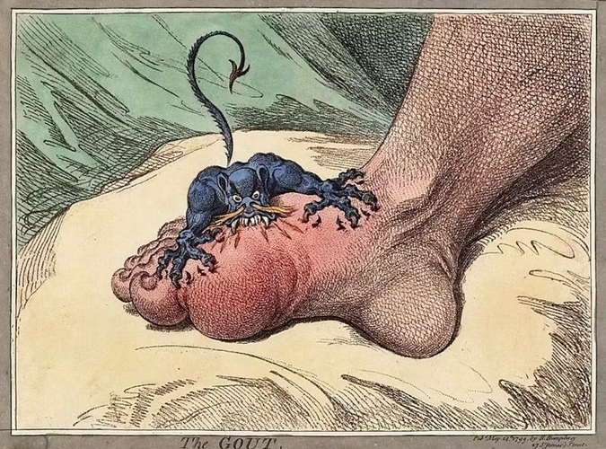 "La goutte" par James Gillray. Publié le 14 mai 1799