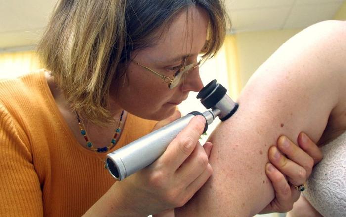 dermatologie peau AFP