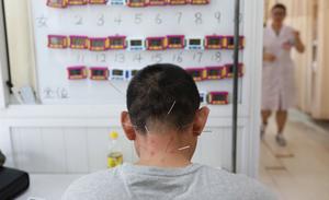 acupuncture Chine